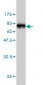 KRT18 Antibody (monoclonal) (M01)